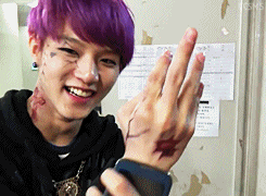 :  Sungmin & his fake makeup injury 
