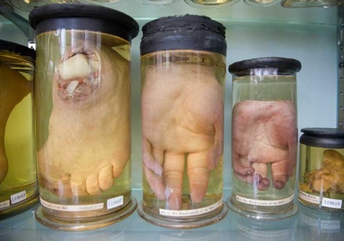 candieddeath:  Human Specimens