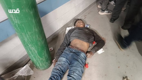 🚨 Earlier This Morning, Over 70 Palestinians Were Martyred, And Over 250 Wounded, After The IOF Opened