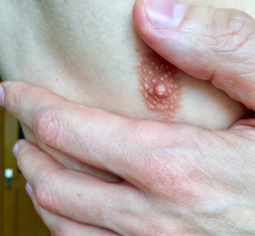 tsoleg: nipple