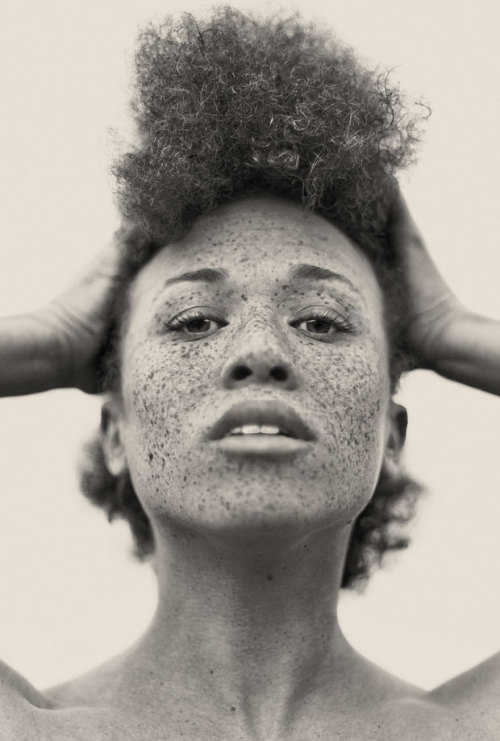 s0mmerspr0ssen:   For his recently published picture book Freckles (Splice Pictures Publishing), the Swiss photographer Reto Caduff has taken pictures of freckled women all over Europe. His pictures prove: freckles are beautiful. Don’t hide yourself