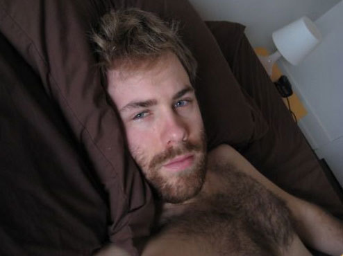Specimens of Male Body Hair
