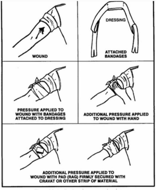 How to dress a wound
