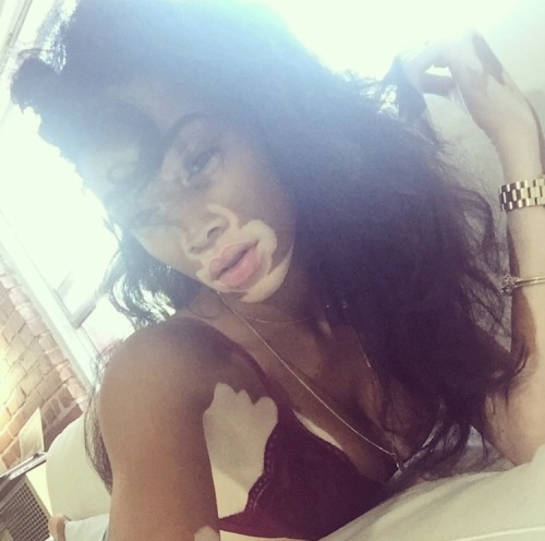 bombshellssonly:  @winnieharlow