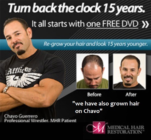 `We have also grown hair on Chavo`