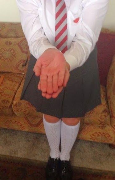 strengersebastian: needsdiscipline:  Memories of my schooldays!!!  Punishment across the palms. Very