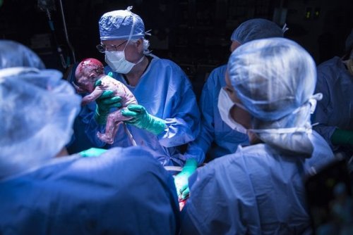 curlicuecal: goodstuffhappenedtoday: Exclusive: First U.S. Baby Born After a Uterus Transplant For t