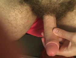 magicianshood:  Foreskin looking relatively healthy.  Better circumcised