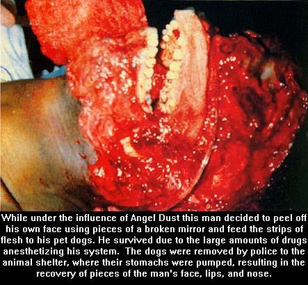 Drugs. Sheesh.