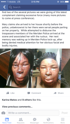 lebritanyarmor:  deycallmesquirt:  lebritanyarmor:  THIS IS MY FRIENDS MOTHER !!   these cops are fuckin’ disgusting yo’ . I can’t believe this shit happened in my town !   #prayforgailbunch .  I can’t believe this Shit happened in my state!!