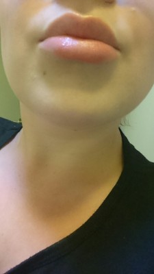 My lovely plump (pumped) lips  