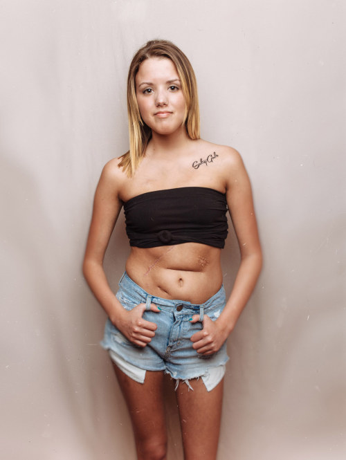 talapishka:    A Photographer Started A Photo Project To Show That Women With Cystic Fibrosis Are GorgeousThe photo project “Salty Girls,” by fashion photographer Ian Pettigrew, is meant to help women with the life-threatening disease take back ownership