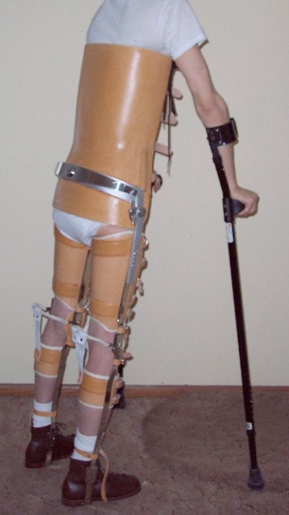 devampwannabe: If I can’t be an amputee - I want this. I want these braces.