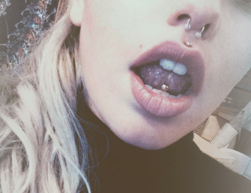 ۵