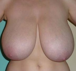 Big Naturals