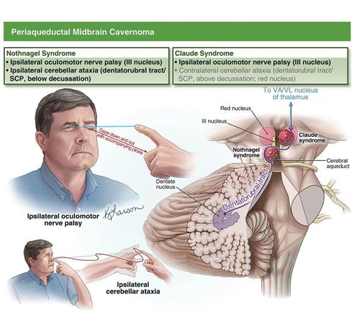 Illustrations created by @kristenlarsonkeil and @petermlawrence for a recently published article on 