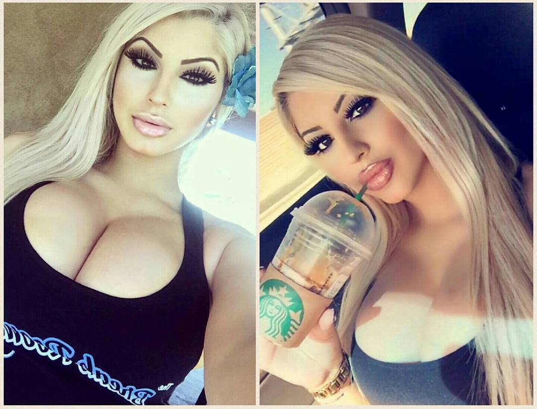 Bimbos-Huge Fake Tits