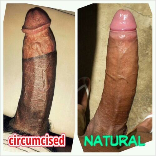 klabbe:  viixxn:  REBLOG if your Circumcised LIKE if your NATURAL 👏🏾👏🏾👏🏾👏🏾  Circ  Both