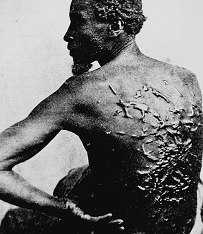 blvckxfatale:   “I am not ashamed of my grandparents for having been slaves. I