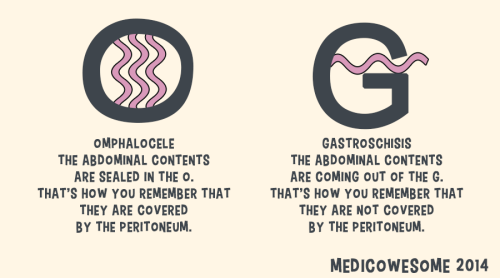 medicowesome:  Gastroschisis vs Omphalocele