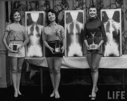 Historicaltimes:  The Winners Of The Miss Perfect Posture Contest At A Chiropractors