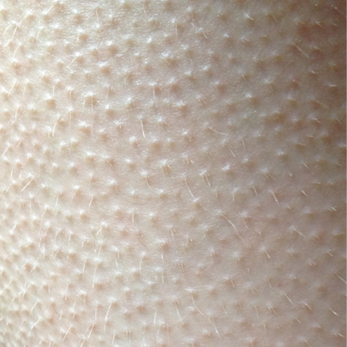 iotiamoenontipensomai:  human skin 