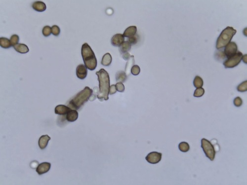 The sooty moulds (fungi) collected and observed from different hosts (Trochetiopsis x benjaminii, So