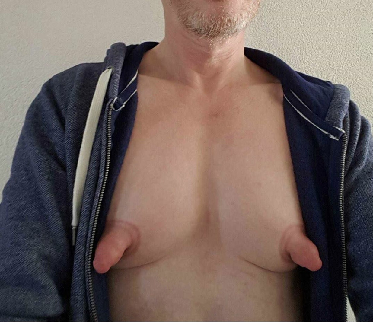 bignipps: