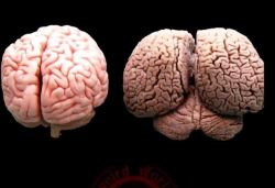 sixpenceee:  A human brain on the left, dolphin brain on the right.