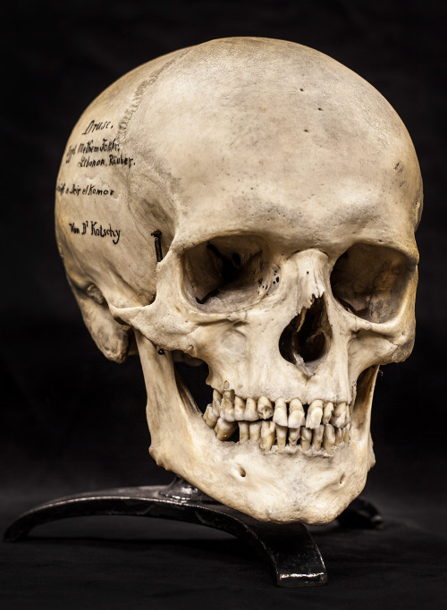 biomedicalephemera:As a side note…If anyone ends up actually adopting a skull for themselves/their f