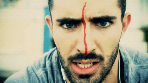 He&rsquo;s got a booboo and that sucks but..i mean&hellip;  Those eyes! OMG