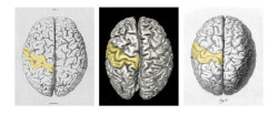 neurosciencestuff:  Unravelling the true identity of the brain of Carl Friedrich Gauss Preserved specimens of the brains of mathematician Carl Friedrich Gauss and Göttingen physician Conrad Heinrich Fuchs, taken over 150 years ago, were switched –