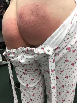 Some butt close ups from my hard punishment