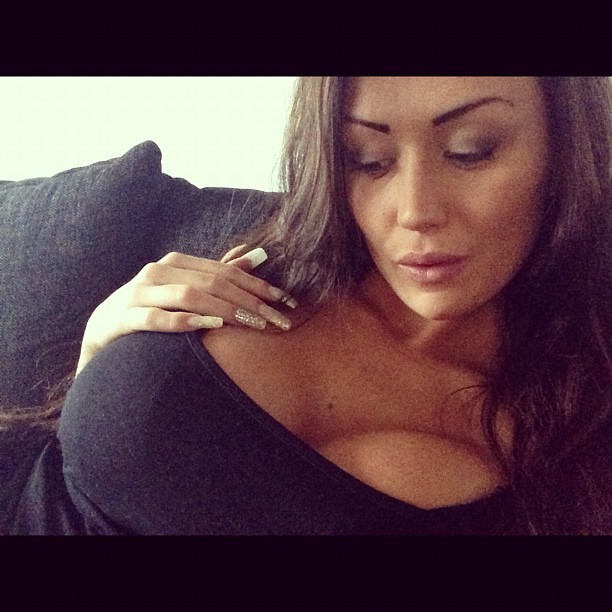 amateur-implant-pics:  stinawenglermodel