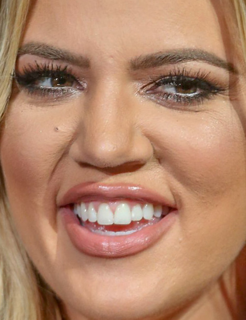 celebritycloseup:  khloe kardashian