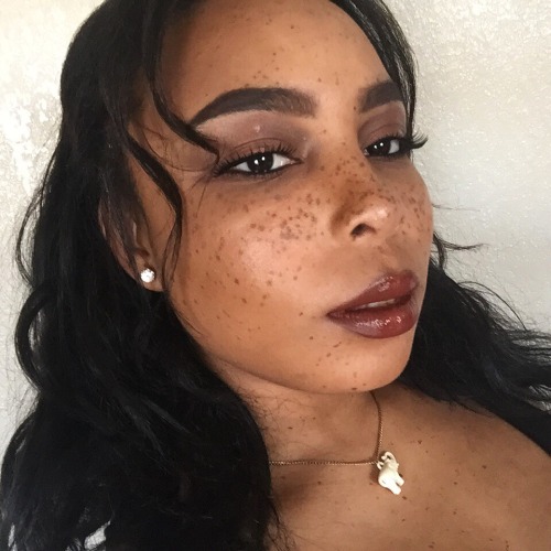 playugly:fuck your fake freckles. #Blackout