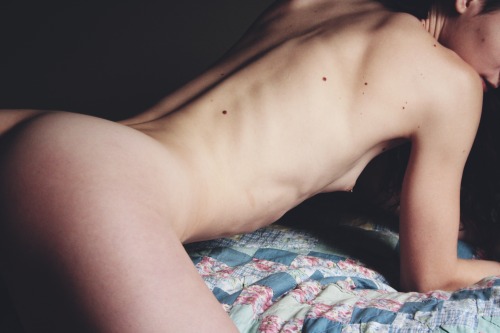 camdamage:  melanocytic study | cam damage by self [x] 