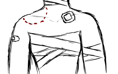 Goretober Day 14: Bitten