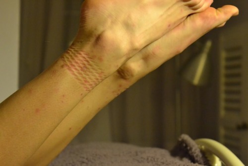 lilsproutbiglungs:  lilsproutbiglungs:Post rope tootsies https://www.patreon.com/join/smolsproutt