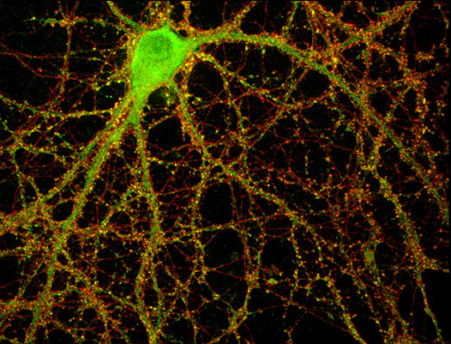 neurosciencestuff:  (Image caption: Pictured is a mouse hippocampal neuron studded with thousands of synaptic connections (yellow). The number and location of synapses — not too many or too few — is critical to healthy brain function. The researchers