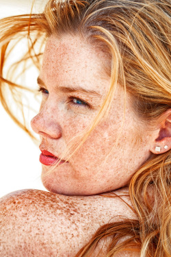 Oh yeah. I love freckles. Beautiful. Gorgeous.
