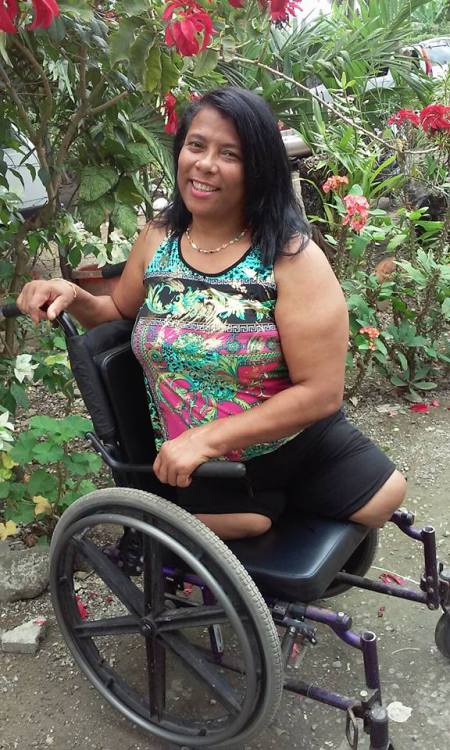 Here’s a Brazilian (?) DAK amputee I found.  She has hundreds of pictures, these were the