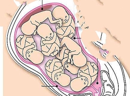 How Many Babies In Mama's Womb? 😳
