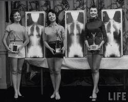 Radiopaedia:  Winners Of The Miss Perfect Posture Contest At The National Chiropractors