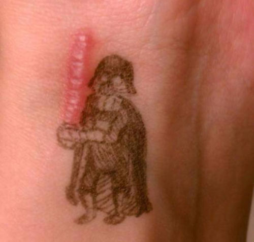 greeneyes-anddimples: pr1nceshawn: Tattoos That Turned People’s Scars Into Works Of Art. I&rsq