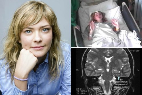 ms-hells-bells: unexplained-events: Autoimmune Disease Acts Like Demonic Possession Susannah Cahalan