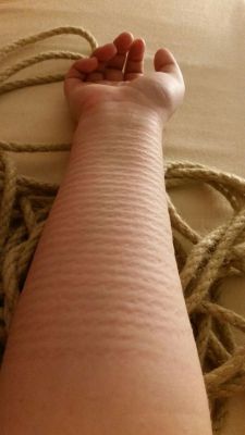 thelovingdominance:  brattydevotion:Aren’t they beautiful? Proud to give these marks to her ;)