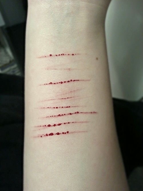blessinngindisguise:  I’m fine..