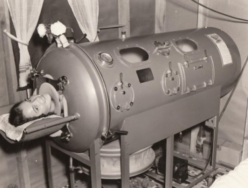 Polio and the Iron Lung,From the early 1900’s up to the 1960’s polio ravaged Europe and 