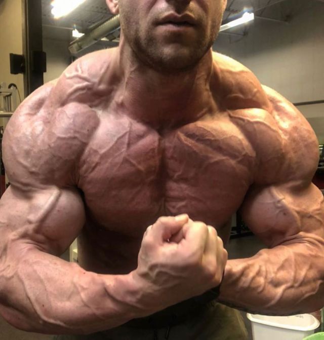 gibboman:The amazing vascularity of Justin